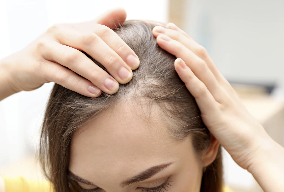 Cabelo caindo muito? As causas vão além do estresse