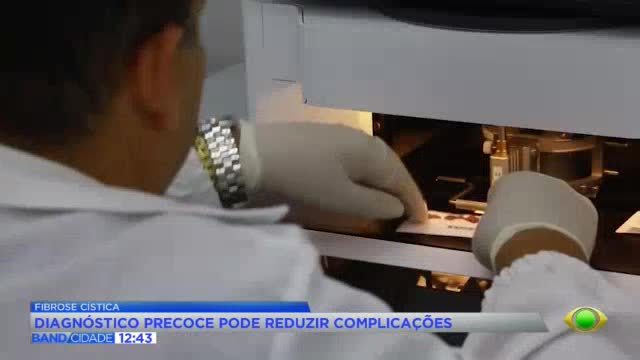 Diagnóstico precoce muda história da fibrose cística no Brasil