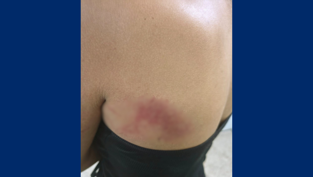 Mulher foge de agressão feita por companheiro e pede ajuda na UPA